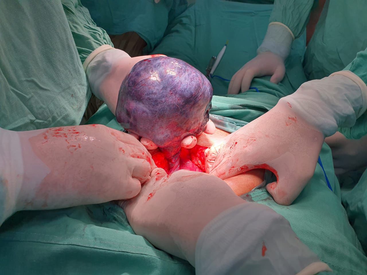 Cirugía Ginecologica