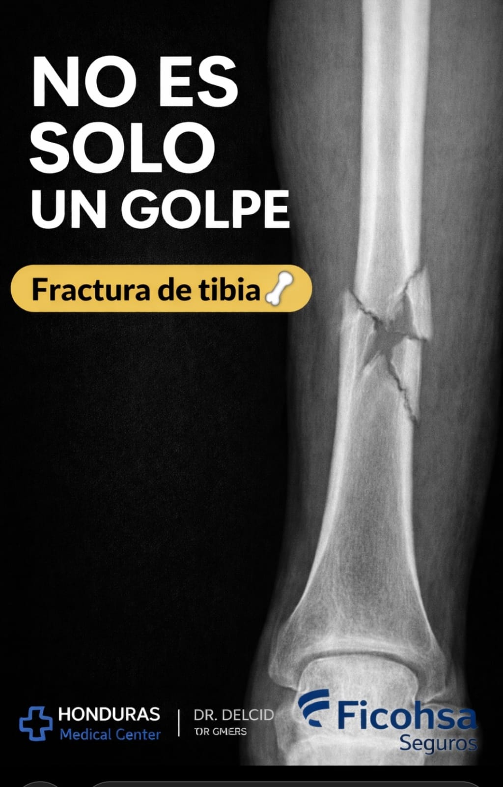 Información