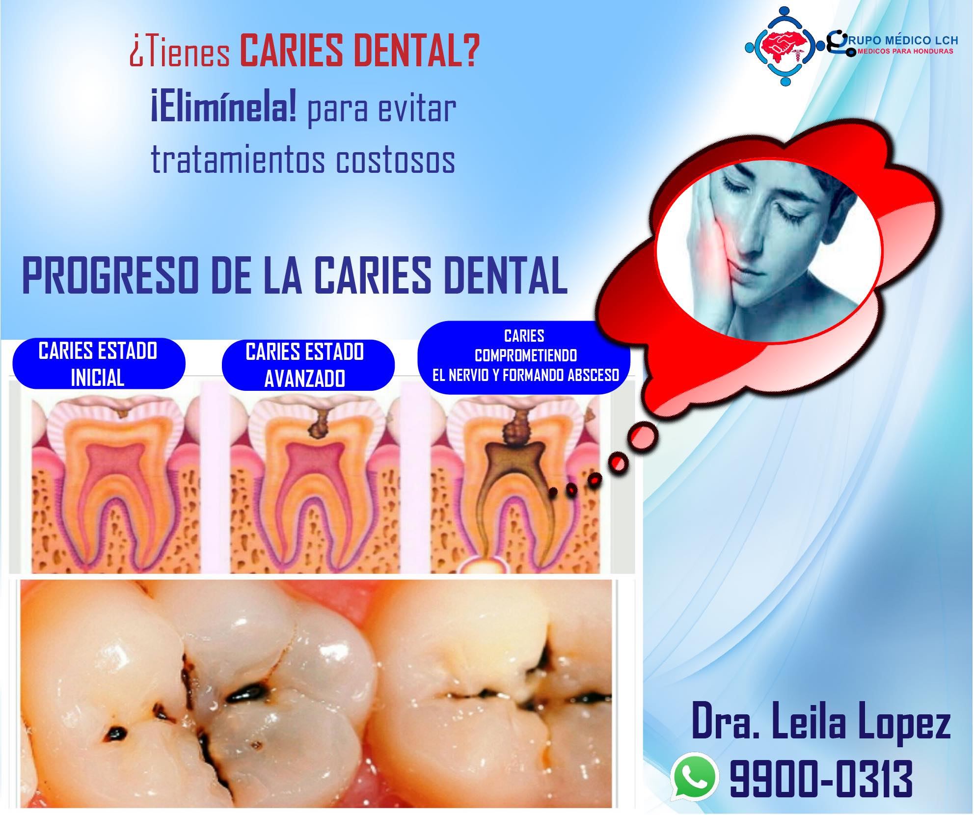 Proceso de la Caries Dental