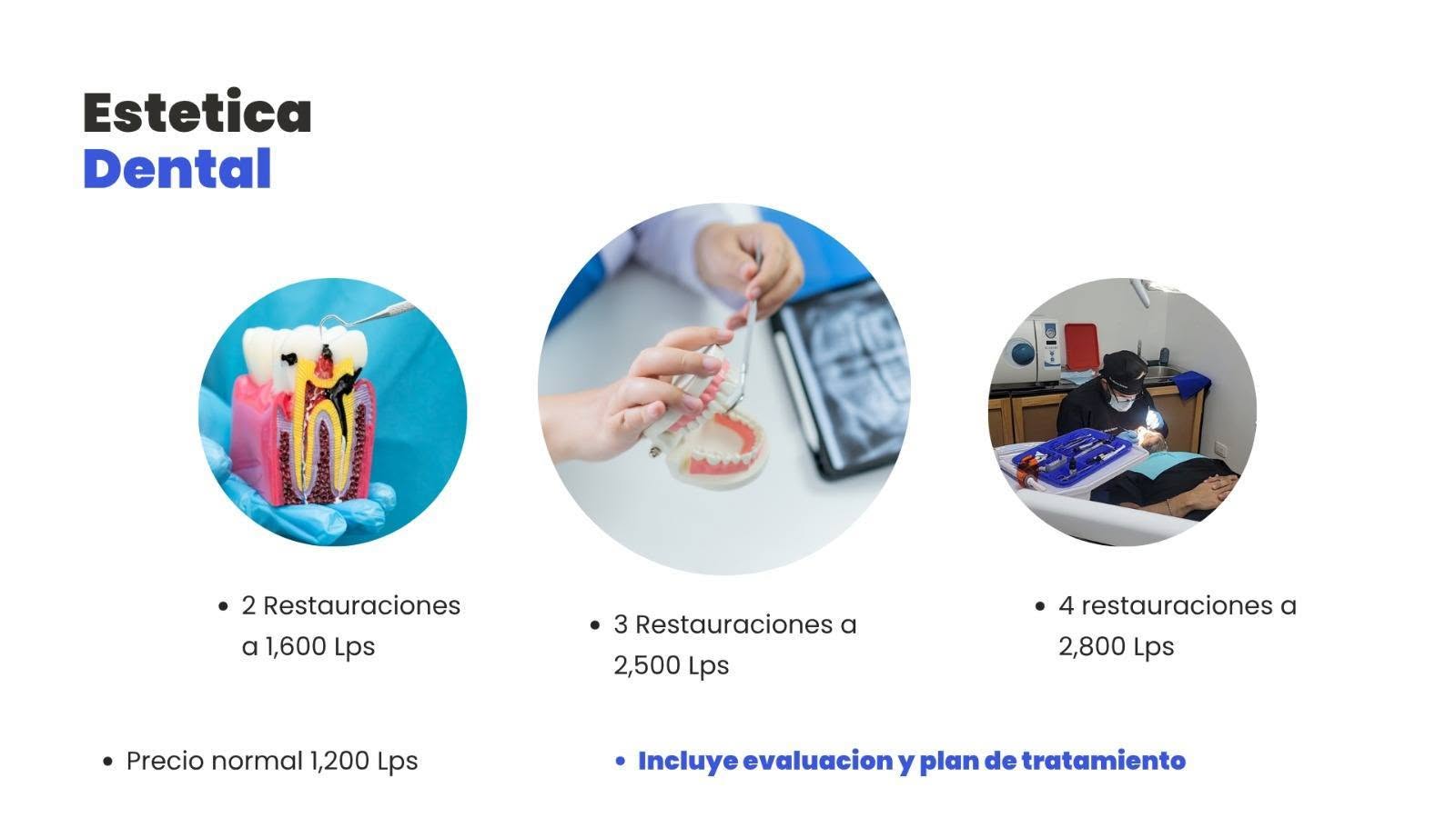 Tratamientos