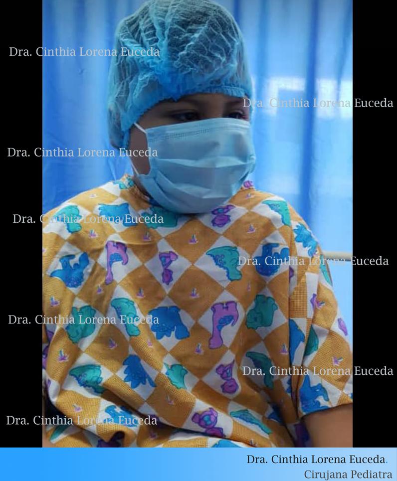 Preoperatorio niño de 4 años