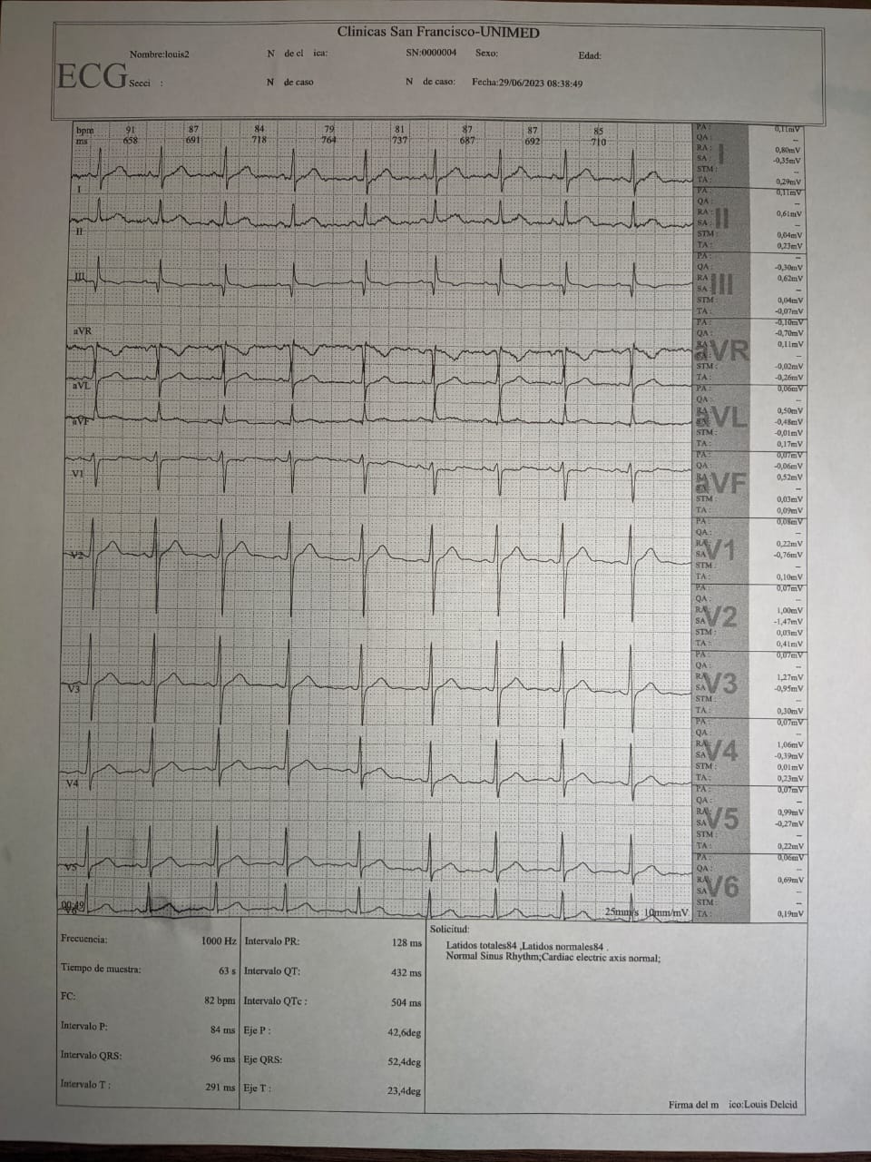 Electrocardiograma 
