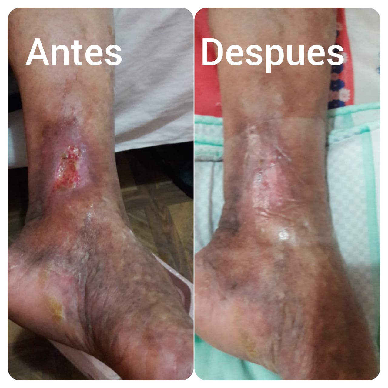 Antes y Después. 