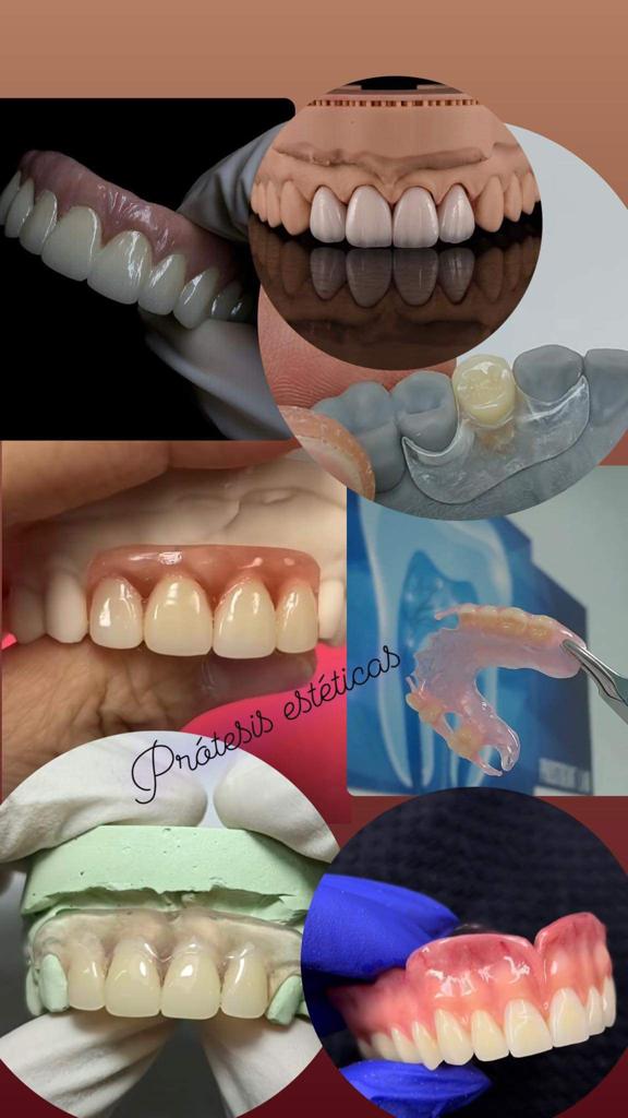 Prótesis estéticas 